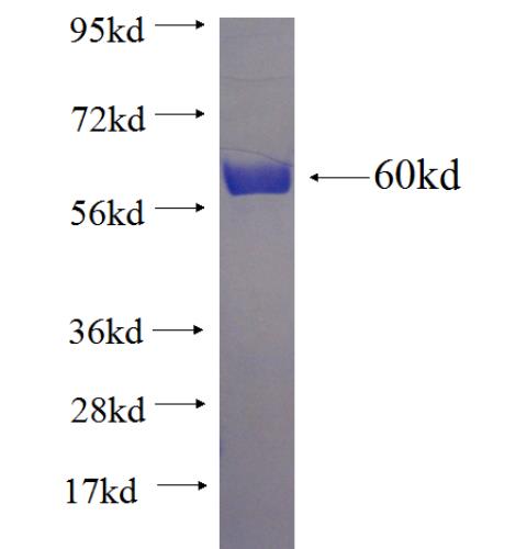 Recombinant human SIRT5 SDS-PAGE