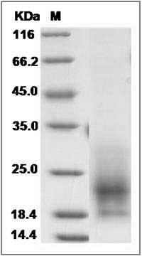 Cynomolgus CD63 / Tspan-30 / Tetraspanin-30 Protein (His Tag) SDS-PAGE