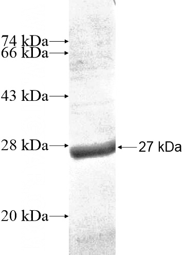 Recombinant Human C1orf57 SDS-PAGE