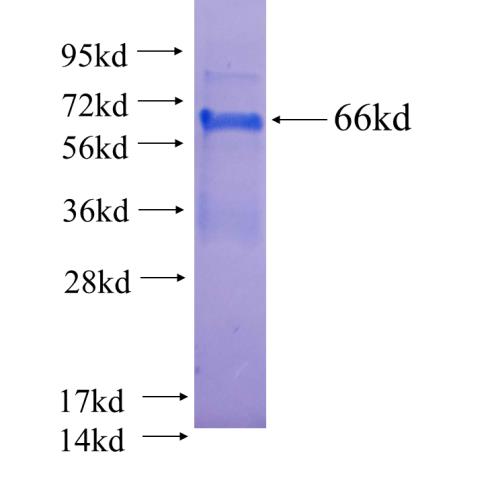 Recombinant human NEUROD1(Full length) SDS-PAGE