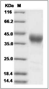 Cynomolgus IL2RA Protein SDS-PAGE