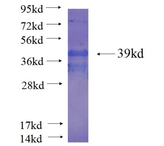Recombinant human SLC16A9 SDS-PAGE