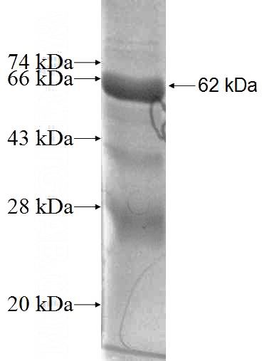 Recombinant Human MAK SDS-PAGE