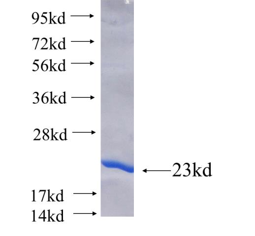 Recombinant human FBXL12 SDS-PAGE