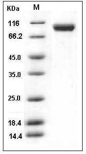 Mouse VCAM1 / L1CAM / CD106 Protein (His Tag) SDS-PAGE