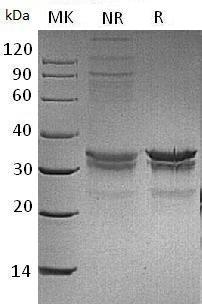 Mouse Sdcbp (His tag) recombinant protein
