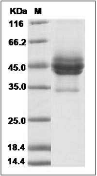 Rat CD63 / Tspan-30 / Tetraspanin-30 Protein (Fc Tag) SDS-PAGE