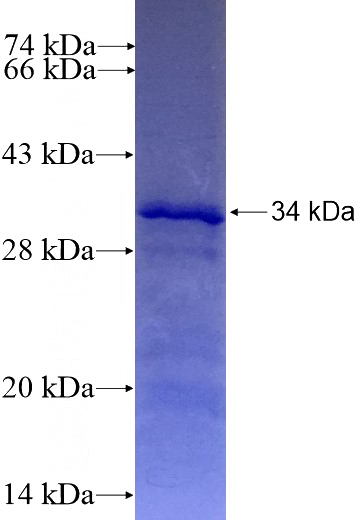 Recombinant Human FUT3 SDS-PAGE
