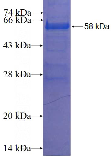 Recombinant Human CENPK SDS-PAGE