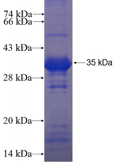 Recombinant Human CCDC137 SDS-PAGE