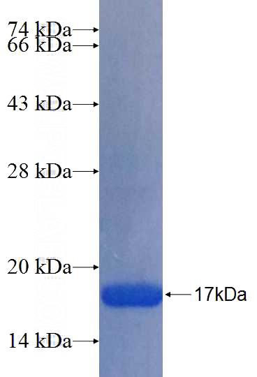 Recombinant Human TMEM119 SDS-PAGE