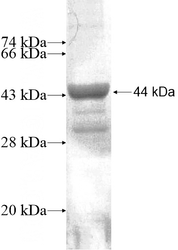 Recombinant Human RAD9B SDS-PAGE