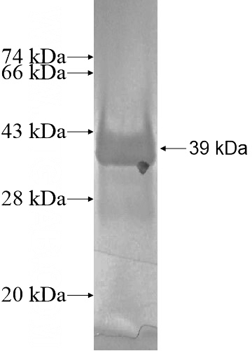 Recombinant Human FAM32A SDS-PAGE