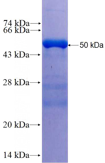 Recombinant Human RNF216 SDS-PAGE