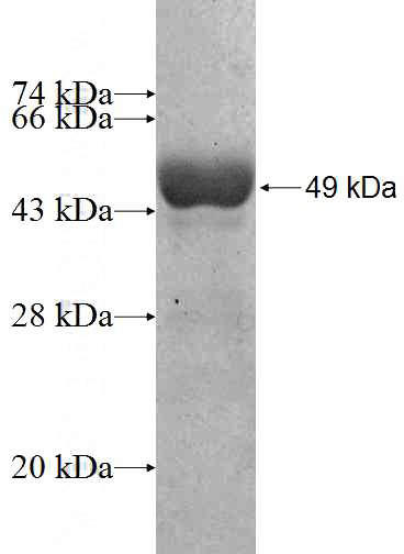 Recombinant Human GCC1 SDS-PAGE