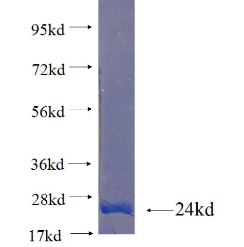 Recombinant human WAS SDS-PAGE