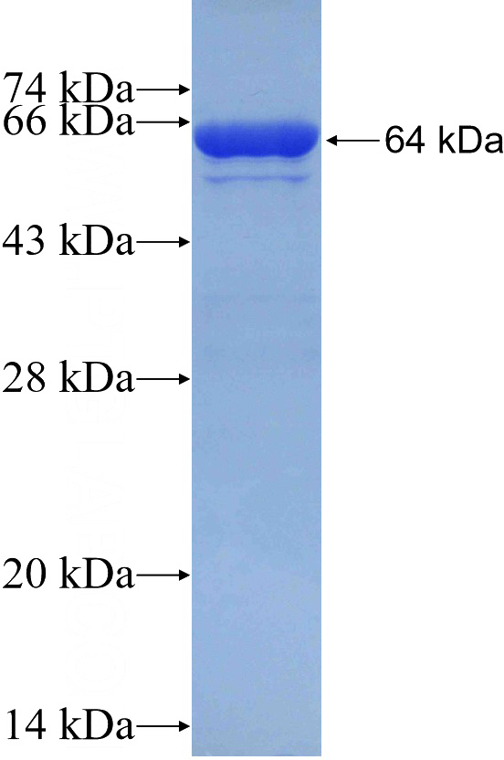 Recombinant Human PEO1 SDS-PAGE