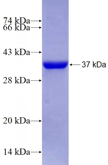 Recombinant Human UPF1 SDS-PAGE