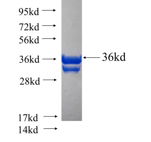 Recombinant human GHRL SDS-PAGE