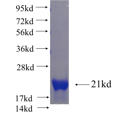 Recombinant human SH2D1B SDS-PAGE