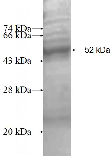 Recombinant Human PSMA2 SDS-PAGE