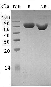 Mouse Lag3 (His tag) recombinant protein