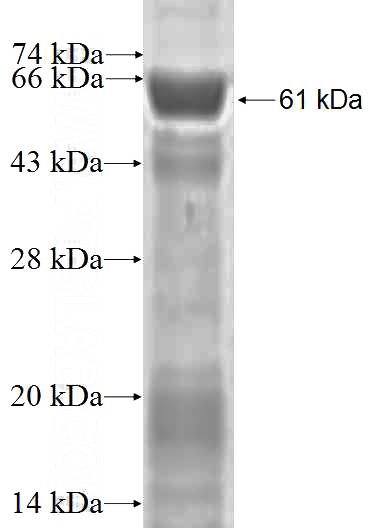 Recombinant Human PHF6 SDS-PAGE
