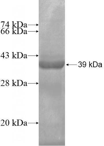 Recombinant Human ZNF343 SDS-PAGE