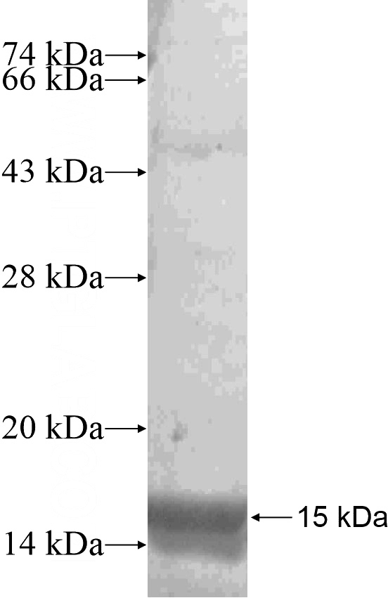 Recombinant Human CXorf15 SDS-PAGE
