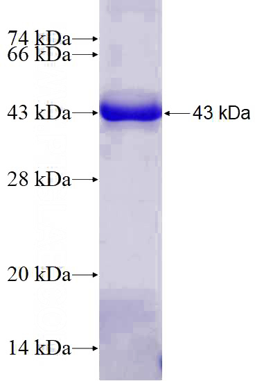 Recombinant Human XRN1 SDS-PAGE