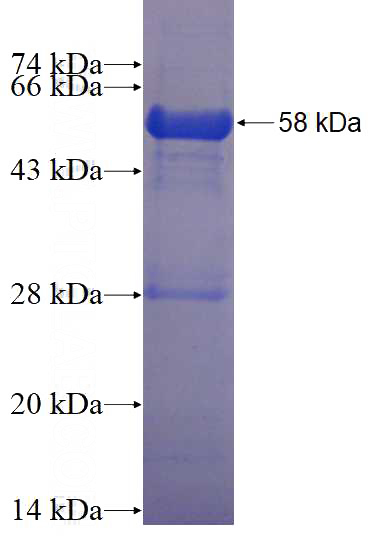 Recombinant Human ZNF184 SDS-PAGE