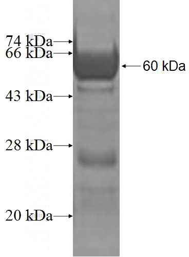 Recombinant Human ANKRD2 SDS-PAGE