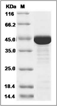 Human CKM / CK-MM Protein (His Tag) SDS-PAGE