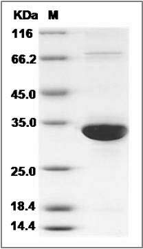 Human ECH1 Protein (His Tag) SDS-PAGE