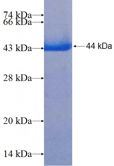 Human NBAS Recombinant protein (6*His tag)