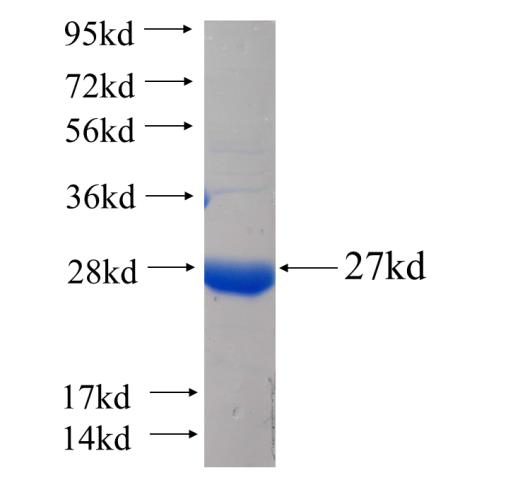 Recombinant human HLA-DPA1 SDS-PAGE