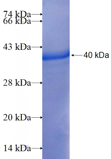 Recombinant Human FOSL1 SDS-PAGE