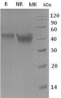 Mouse St6galnac2/Siat7/Siat7b (His tag) recombinant protein