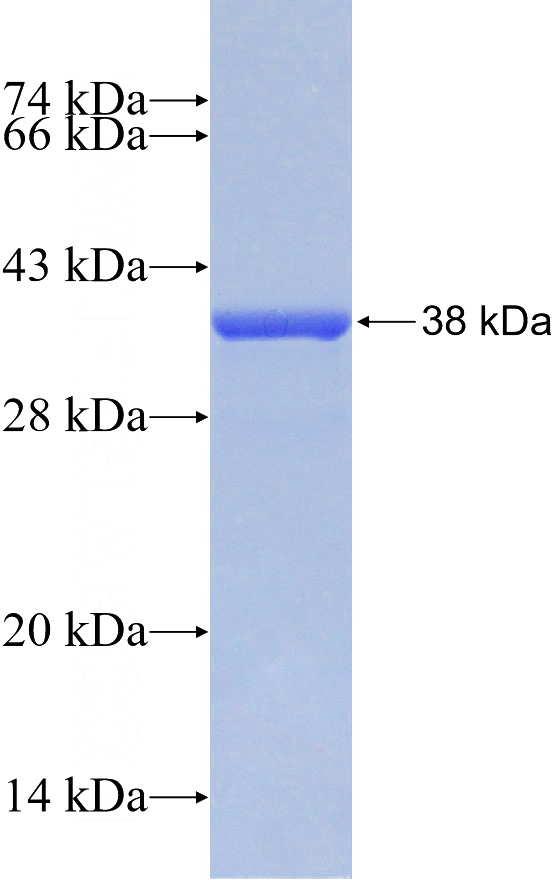 Recombinant Human FTO SDS-PAGE