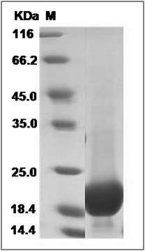 Human GMFG / Glia maturation factor, gamma Protein (His Tag) SDS-PAGE