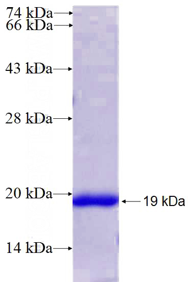 Recombinant Human DPYD SDS-PAGE