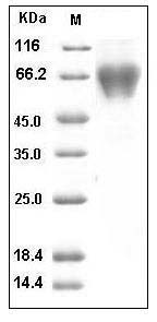 Human TRAIL R4 / CD264 / TNFRSF10D Protein (His & Fc Tag) SDS-PAGE