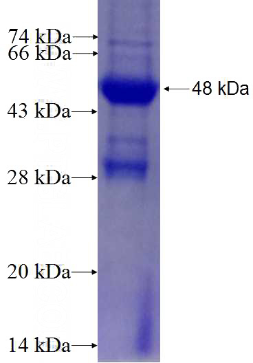 Recombinant Human ANO9 SDS-PAGE
