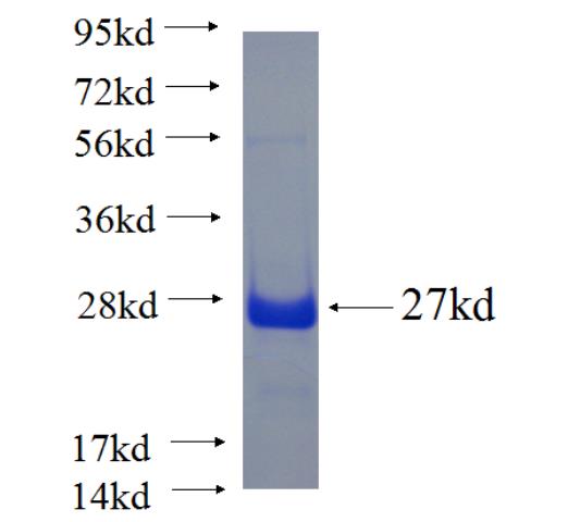Recombinant human ARHGAP22 SDS-PAGE