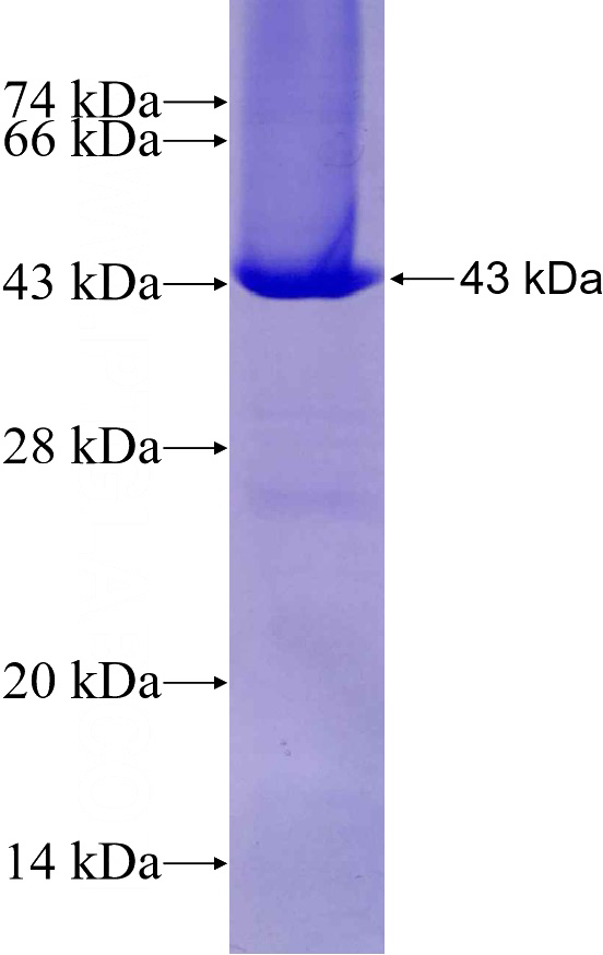 Recombinant Human Syntaxin 18 SDS-PAGE