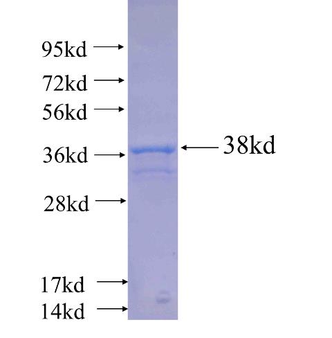 Recombinant human PSENEN(Full length) SDS-PAGE
