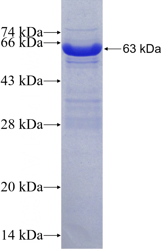 Recombinant Human NAGK SDS-PAGE