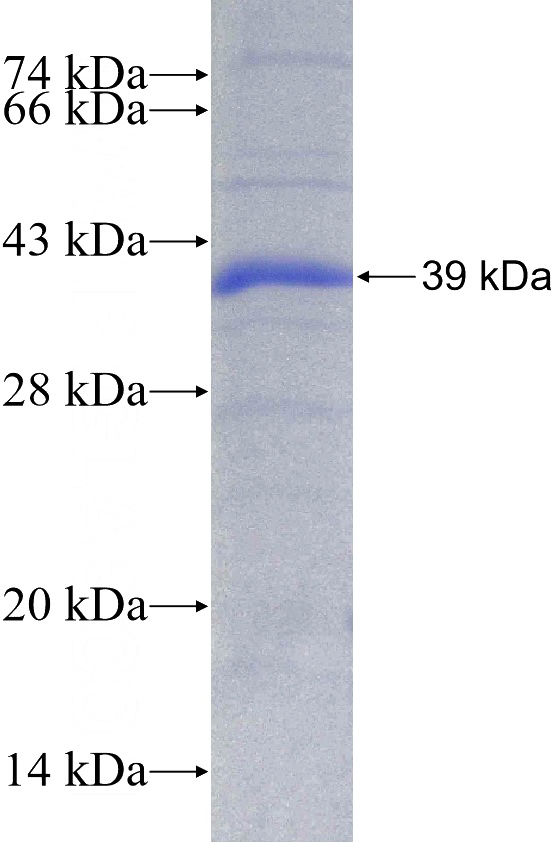 Recombinant Human NAT9 SDS-PAGE