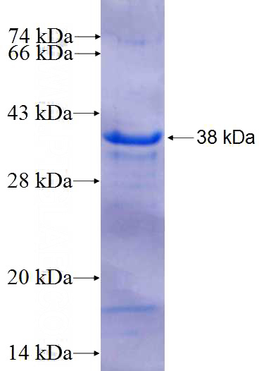 Recombinant Human MYOZ1 SDS-PAGE