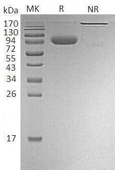 Human CD274/B7H1/PDCD1L1/PDCD1LG1/PDL1 (Fc & Avi tag) recombinant protein